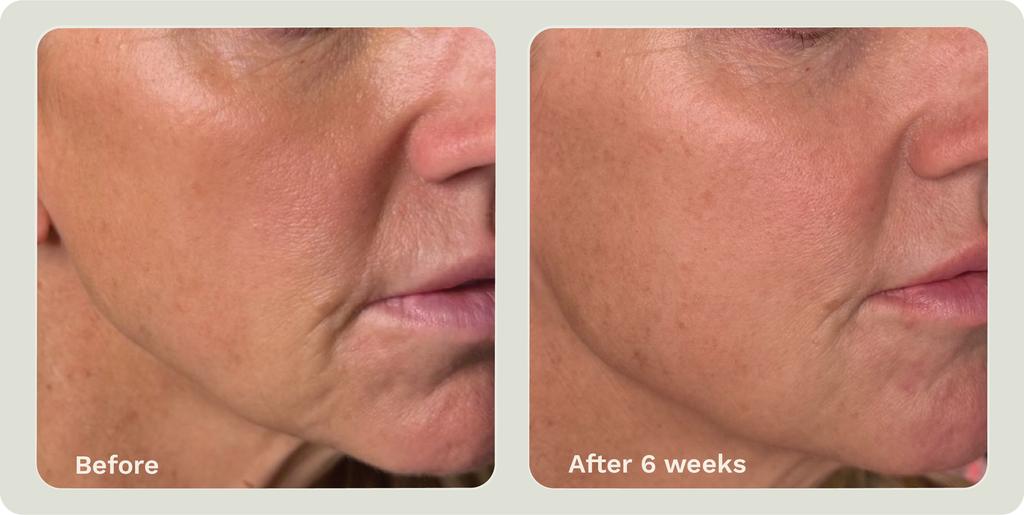 Adipeau Ultimate Bundle