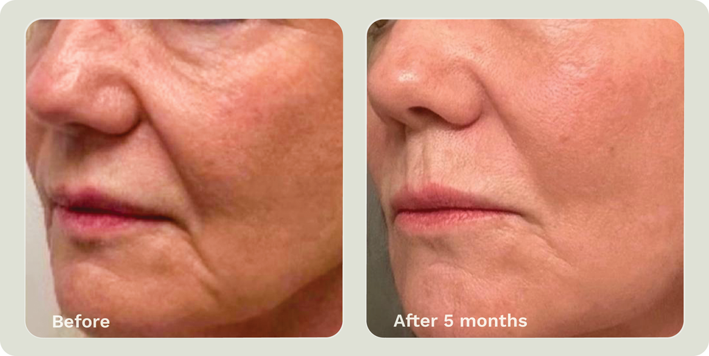 Adipeau Ultimate Bundle